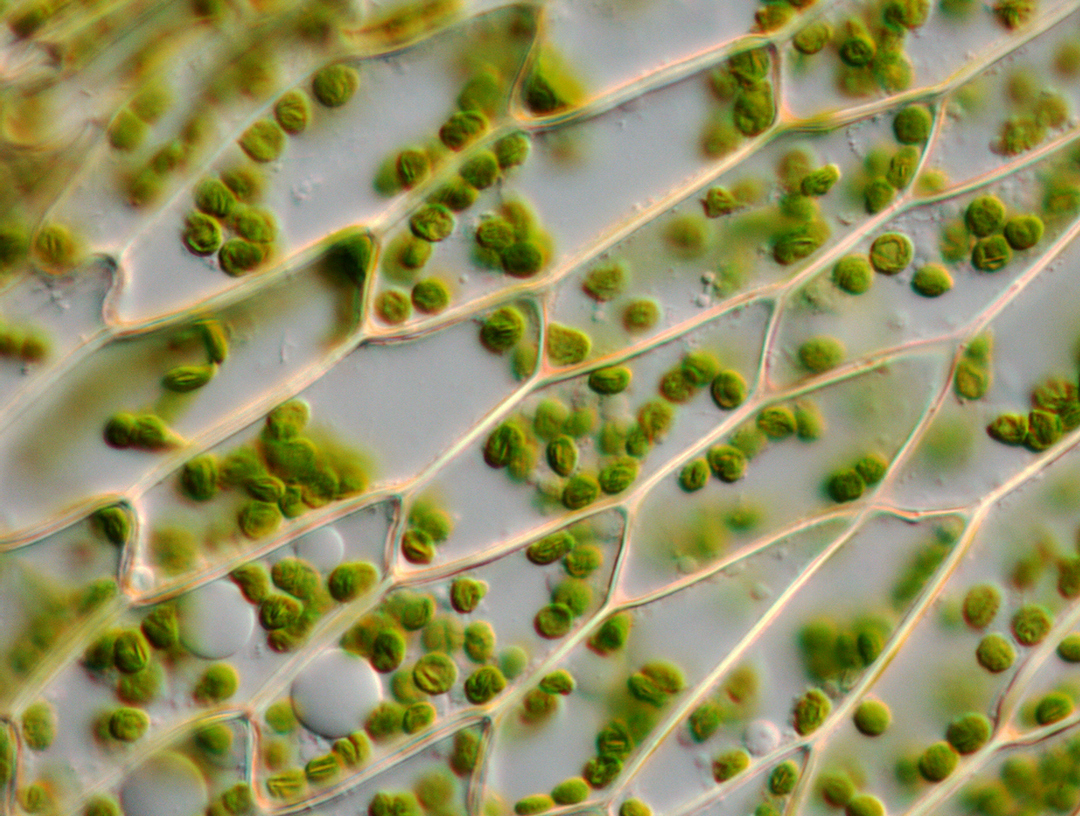 Microscope image of moss leaf cells and chloroplasts